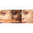 L'Oréal Paris Revitalift Clinical Serum [Siero antirughe] Con il 12% di vitamina C pura + vitamina E + acido salicilico.