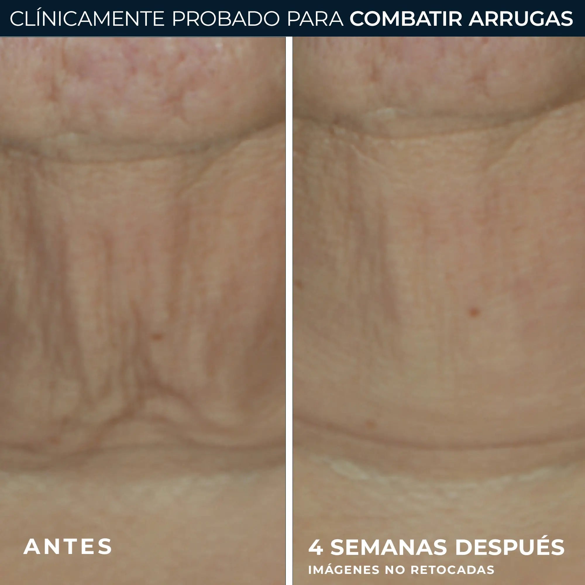 Roc Skincare Iberia Roc® Derm Correxion® Stick rassodante 30G