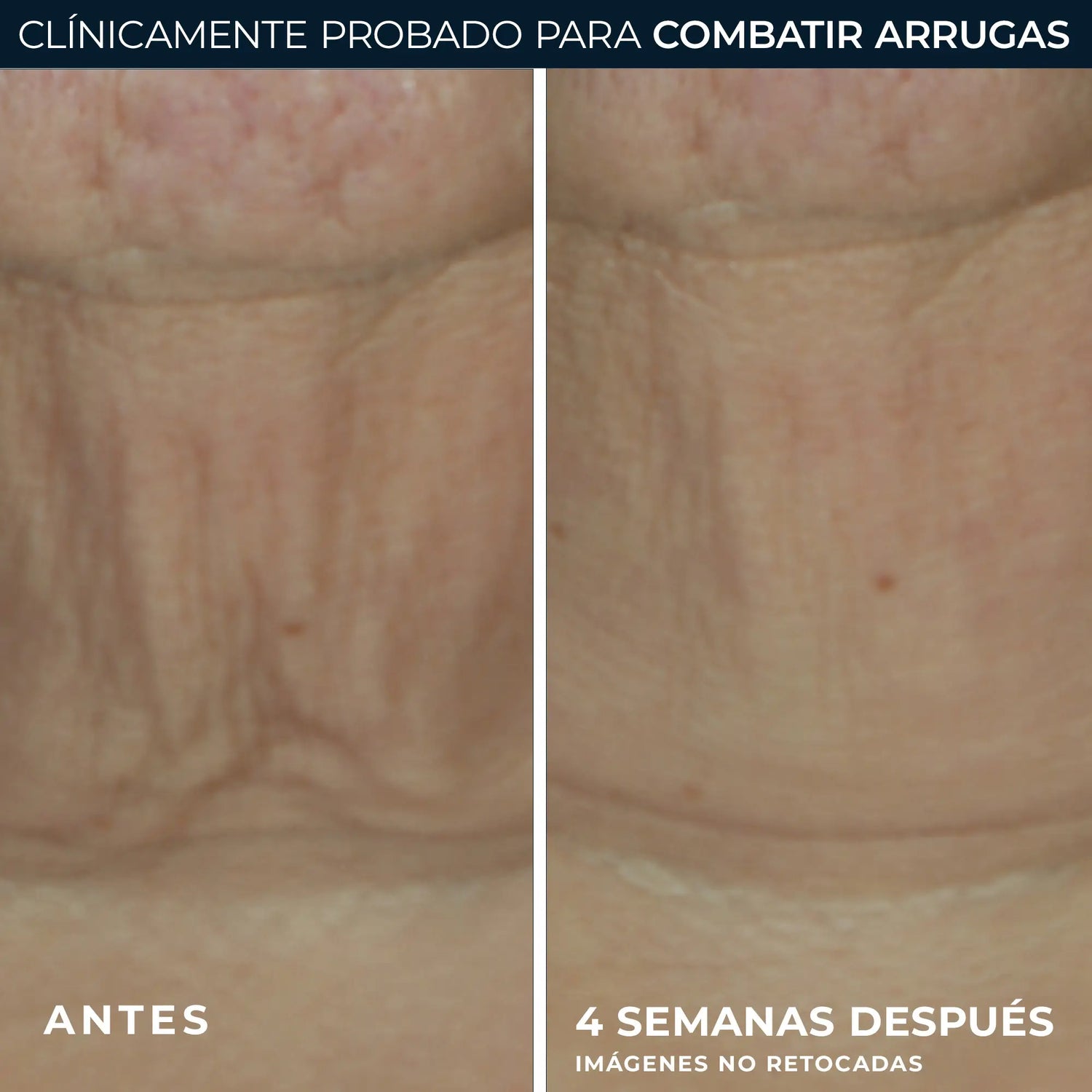 Roc Skincare Iberia Roc® Derm Correxion® Stick rassodante 30G