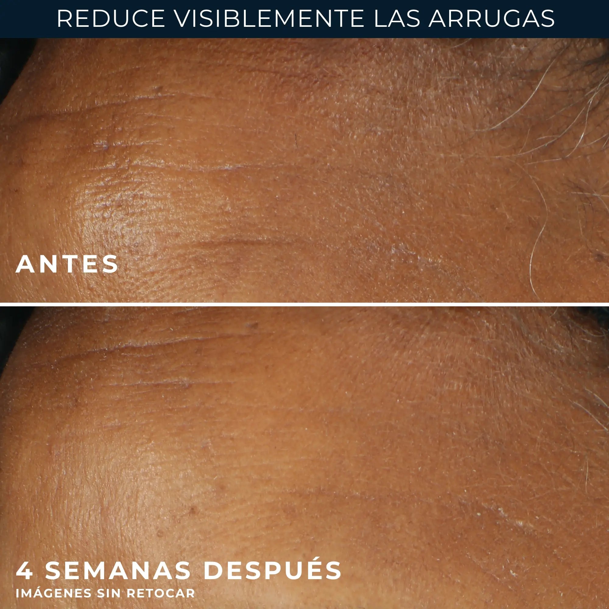 Roc Skincare Iberia Roc® Wrinkle Correct Crema Giorno Spf30 30Ml