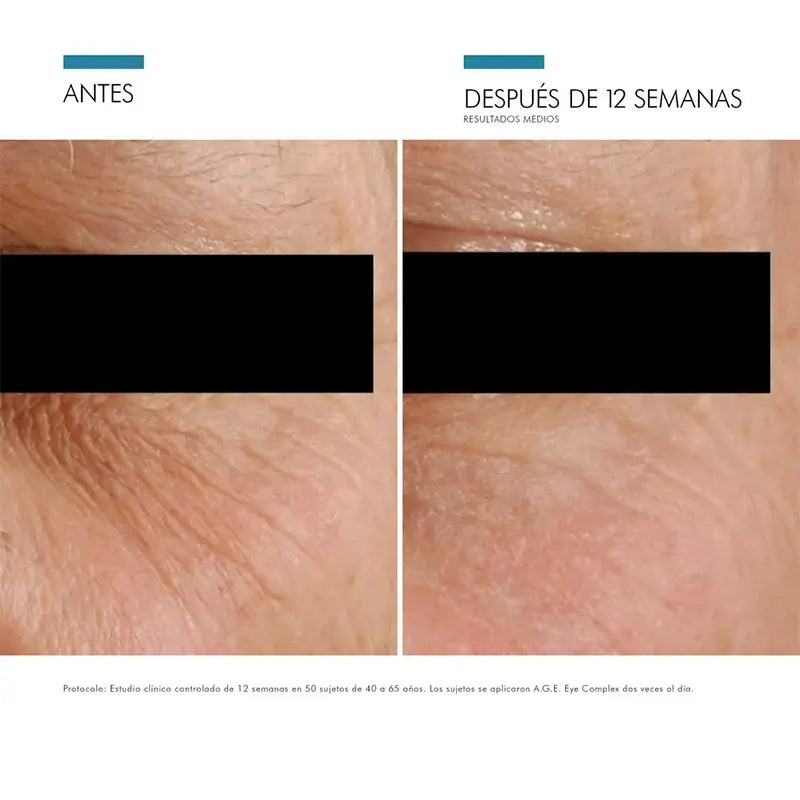 SkinCeuticals A.G.E. Complesso Occhi 15 ml