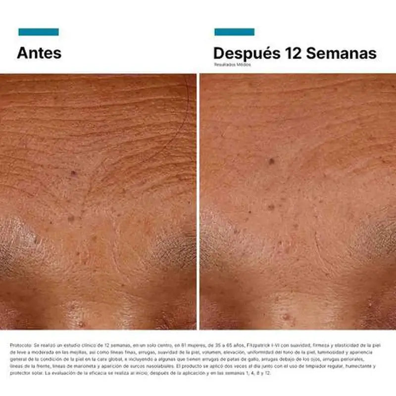 Skinceuticals Acido Ialuronico Siero Intensificatore Multi-Glic, 30 ml