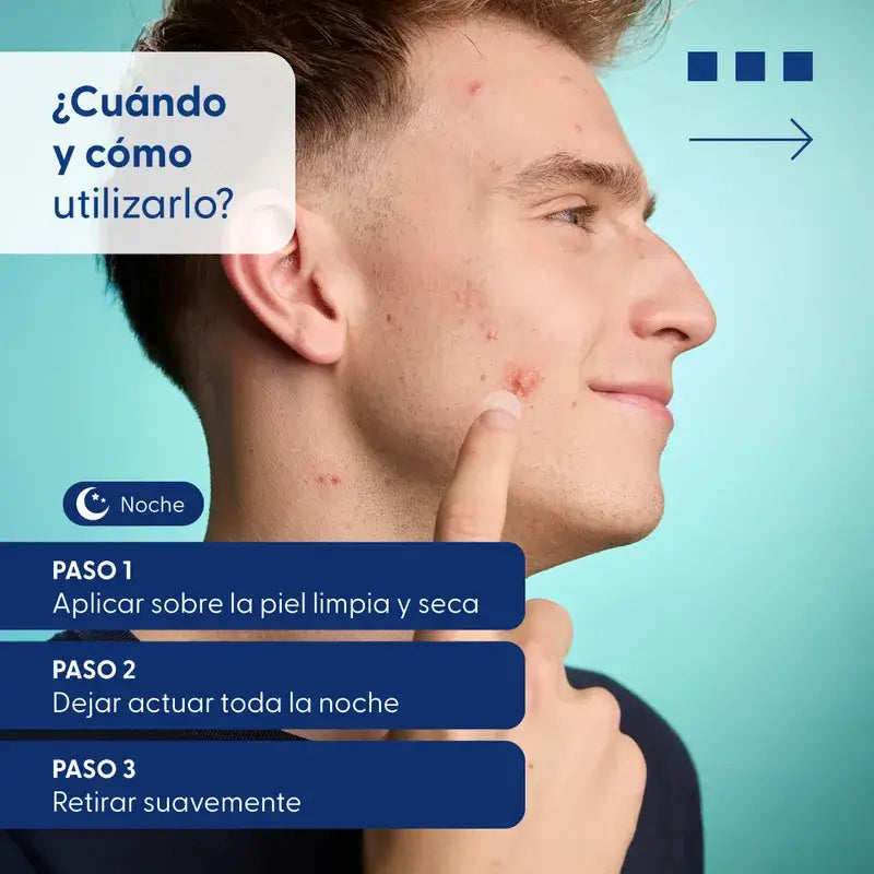 Urgo Spots Cerotti idrocolloidi Micro Needling, 9 unità