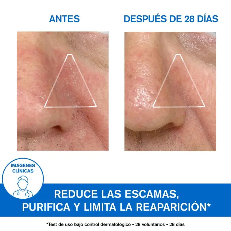 Uriage Ds Emulsione Lenitiva 40Ml non profumata